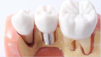 New Smiles Implant & Orthodontic Center image 3